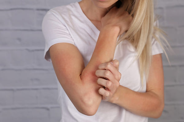 Eczema e Omeopatia - Omeopatia per la cura dell'eczema